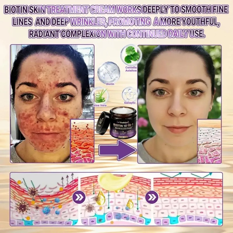 Crema Restauradora De Piel 10 En 1 Con Biotina Natural
