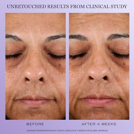 Lancôme Rénergie - HPN 300, Crema Facial Hidratante Antiedad, Con 300 Péptidos, Ácido Hialurónico y Niacinamida, Fórmula de Rápida Absorción para Piel Madura, Refill 50 ml