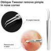 5PCS Blackhead Remover Comedone Extractor,Stainless Pimple Popper Tool，Curved Blackhead Tweezers