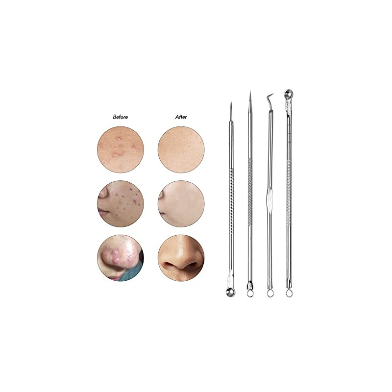 Kit de herramientas Remover Pimple Popper para granitos manchas espinillas