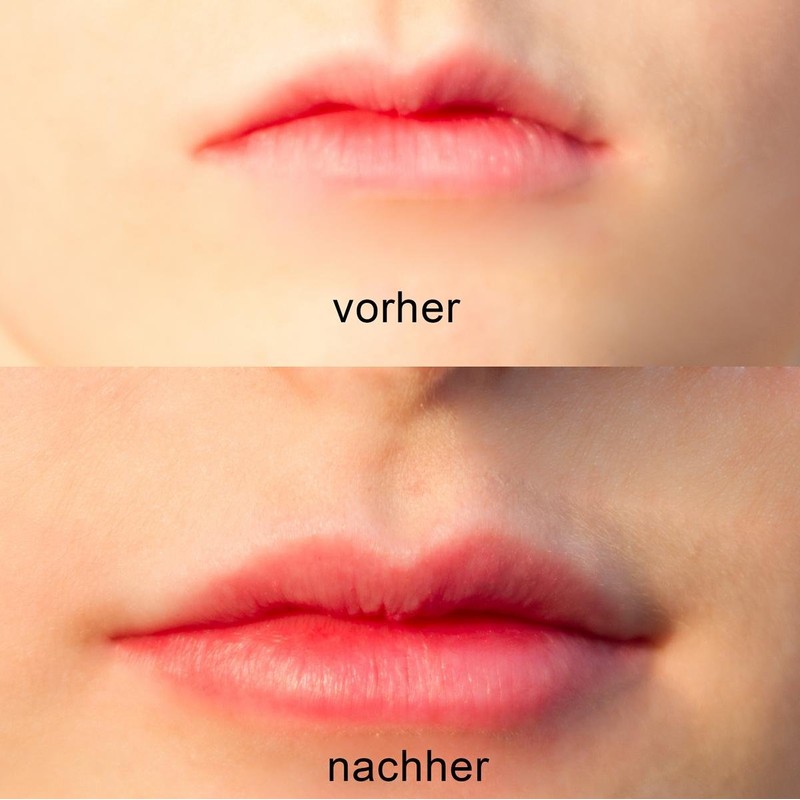 KOBERT GOODS Lip Booster, The Quick Boost for Fuller Lips