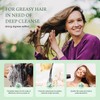 ANNAS Nettle Shampoo - Organic Formula,Helps Regulate Sebum Production, Reduce