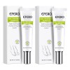 Compuesto completo para tratamiento de tiña Efero Nails, color blanco