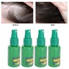 30ml 4PCS Ginger Hair Growth Spray Nutritious Moisturizing Hair Root