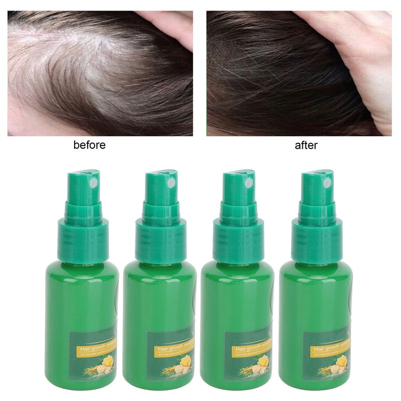 30ml 4PCS Ginger Hair Growth Spray Nutritious Moisturizing Hair Root