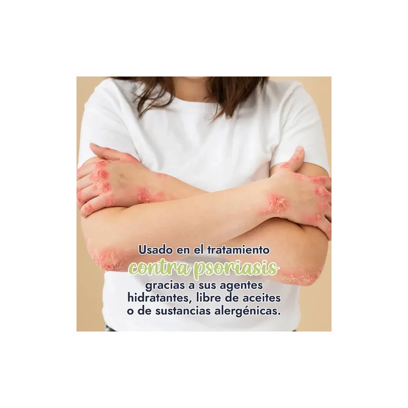 Hidrolato De Manzanilla Calmante, Descongestivo 120 Ml Todo Tipo De