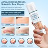 Mitgary Crema Avanzada Para Cicatrices, Gel De Silicona Para Cicatrices,