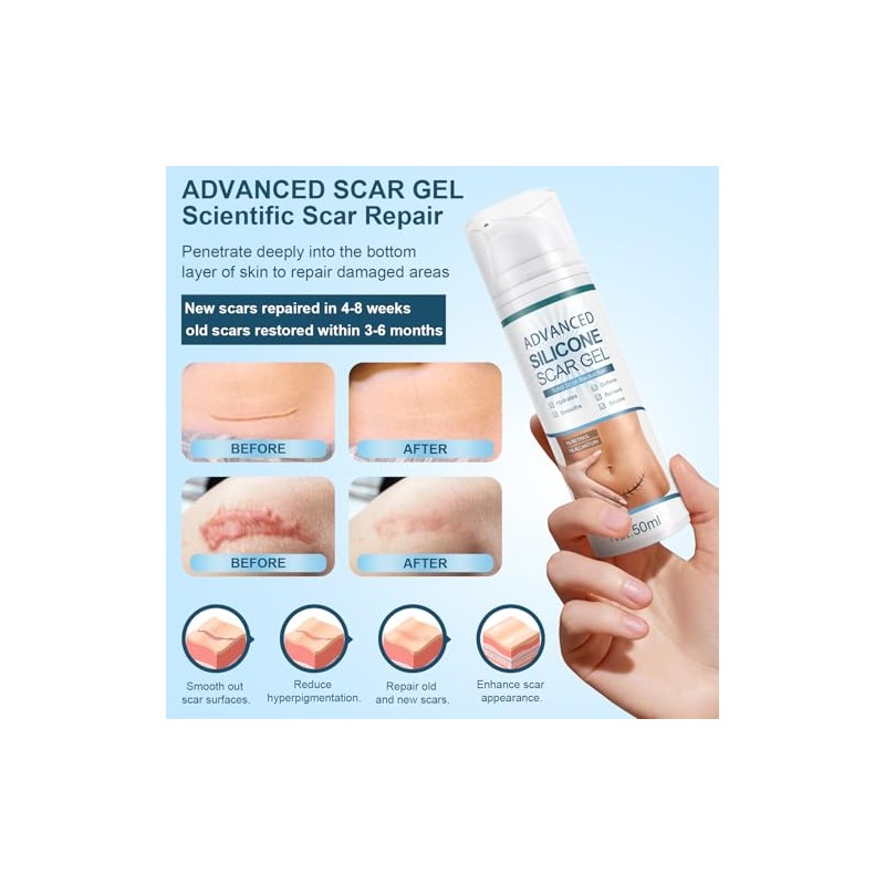 Mitgary Crema Avanzada Para Cicatrices, Gel De Silicona Para Cicatrices,