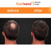 Carlxanz Hair Fiber Classic (4 x 25g)