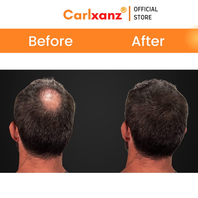 Carlxanz Hair Fiber Classic (4 x 25g)