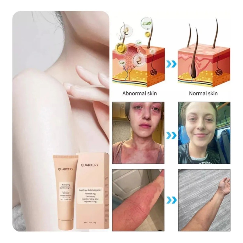 1pc Gel Exfoliante Purificante Quarxery Exfoliantequarxery