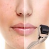 Facial Massage Face Roller for Circulation and Muscle Relaxation Roller BL05080 Gold 0.2