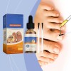 Tratamiento De Uñas De Los Pies Para Mujeres, Extractos De