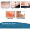 Parche de Silicona Médica para Cicatrices – Reutilizable y Efectivo