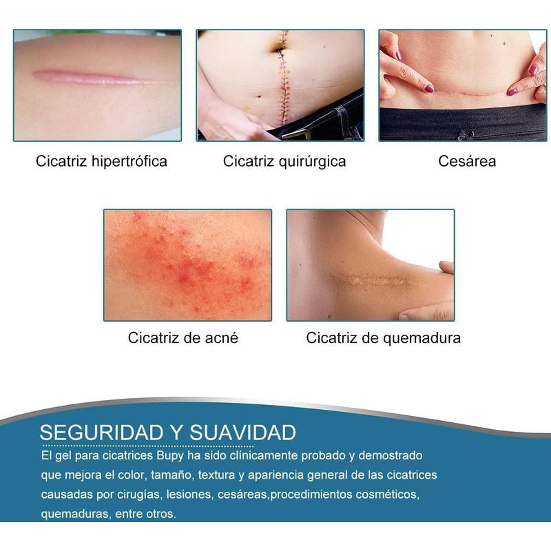 Parche de Silicona Médica para Cicatrices – Reutilizable y Efectivo