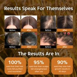 Rice Water Hair Growth Shampoo, Natural Rice Water Thickening & Regrowth Formula for Men & Women - Infused with Biotin, Castor Oil, Rosemary, For Weak, Brittle, Thinning Hair & All Hair Types 11.8 Oz