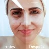 Kit Purificante Acné Lilo Skincare Niacinamida Y Retinol