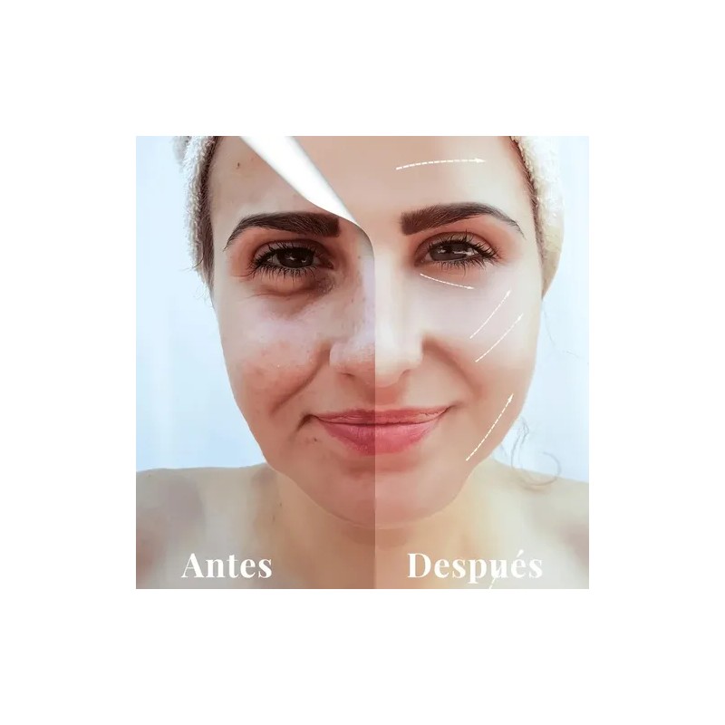 Kit Purificante Acné Lilo Skincare Niacinamida Y Retinol