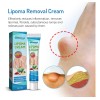 Crema Limpiadora Block Care Products Lipoma Nursing Cream