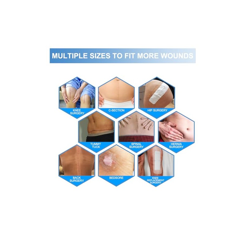 30 Pack Waterproof Adhesive Island Dressings for Surgery Recovery