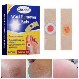 Wart Remover, Corn Complete Removal, Corn Remover, Foot Corn Remover Pads, Plantar Wart Removal, Penetrates and Removes Common and Plantar Warts, Callus, Stops Wart Regrowth