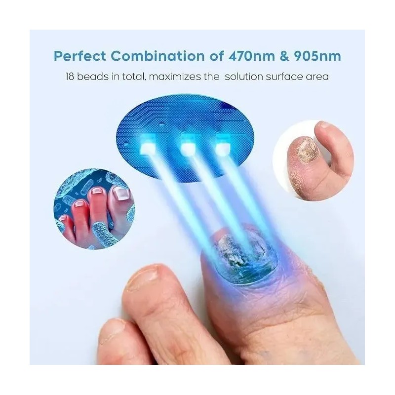 Dispositivo Ligero Para Hongos En Las Uñas De Los Pies