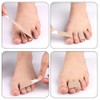 Natiform Finger Separator, Leg Toe Overlap Prevention Band, Metatarsal Stretcher