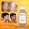 Clear Within Clear Skin Vitamin - with 10 Natural Ingredients
