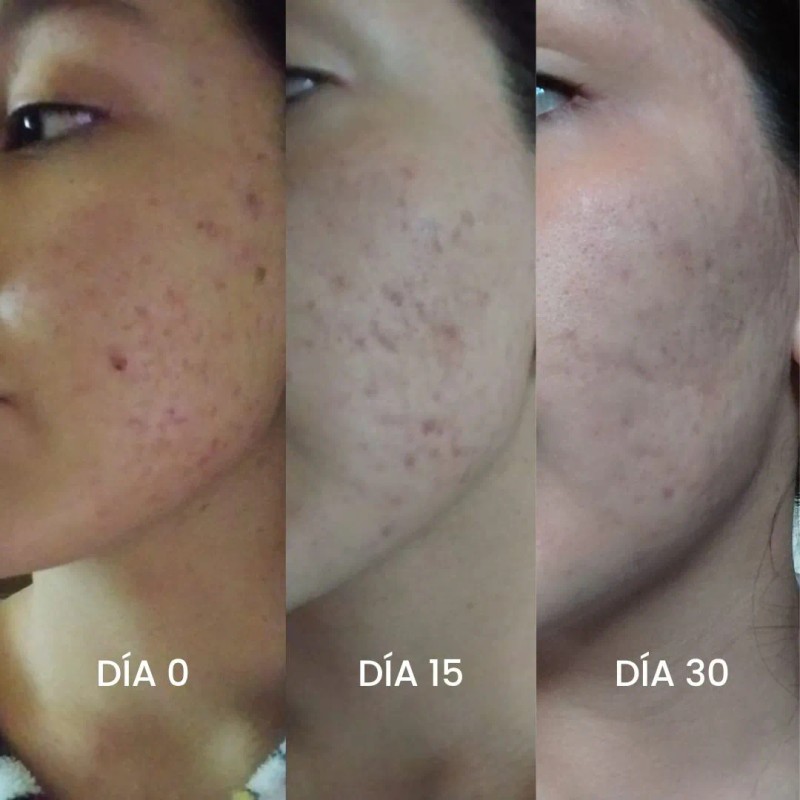 Multi Protección Uv (anti-manchas, Cicatrizante, Bloqueador)