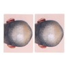 Man Bald Micropigmentattion Practice Skin Silicone Hairline Microblading Practice Pads