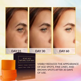 Jabn Blanqueador Lotlash de Crcuma y cido Kjico para Manchas 260g                                                                                     