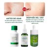 Serums Faciales + Rodillo Gua Sha Jade Masaje Paquete 5pzs