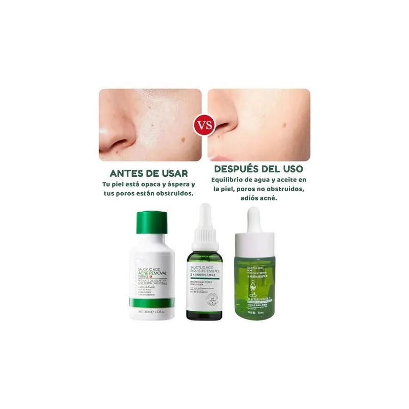 Serums Faciales + Rodillo Gua Sha Jade Masaje Paquete 5pzs