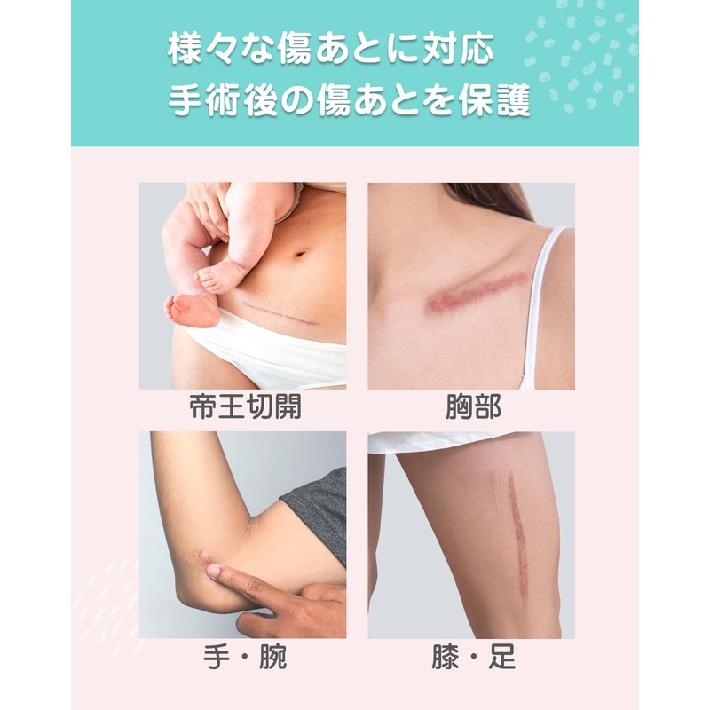 Scar Care Tape, Breathable Keloid Tape, For Wound Care, Post
