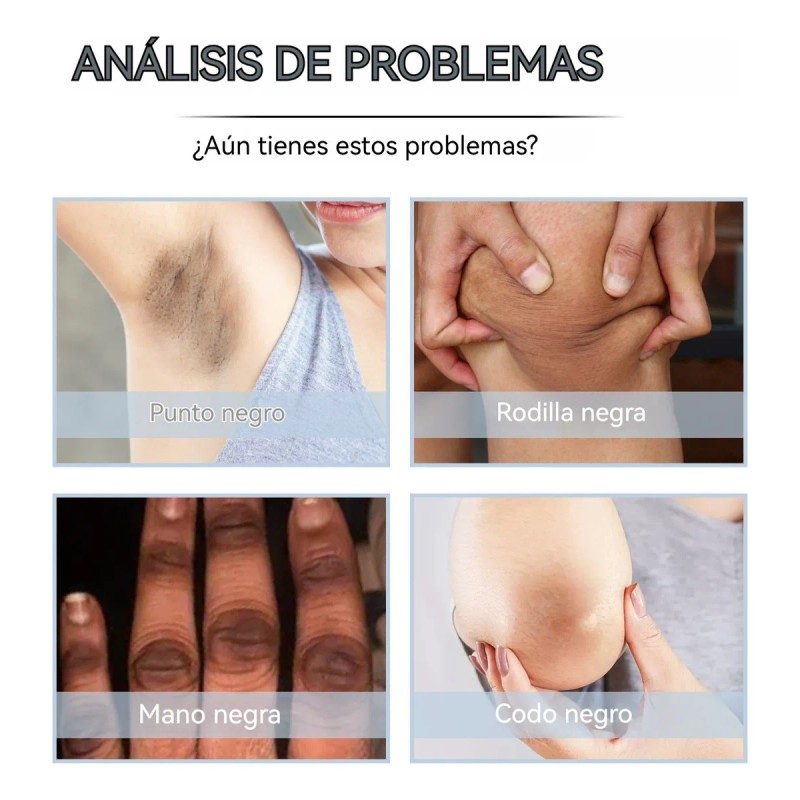 Ch Crema For Acantosis Y Melasma 50ml 1pcs .1