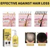 100ml Ginger Hair Regrowth Shampoo Dandruff Removal Itching Relief Deep