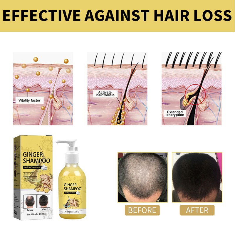 100ml Ginger Hair Regrowth Shampoo Dandruff Removal Itching Relief Deep