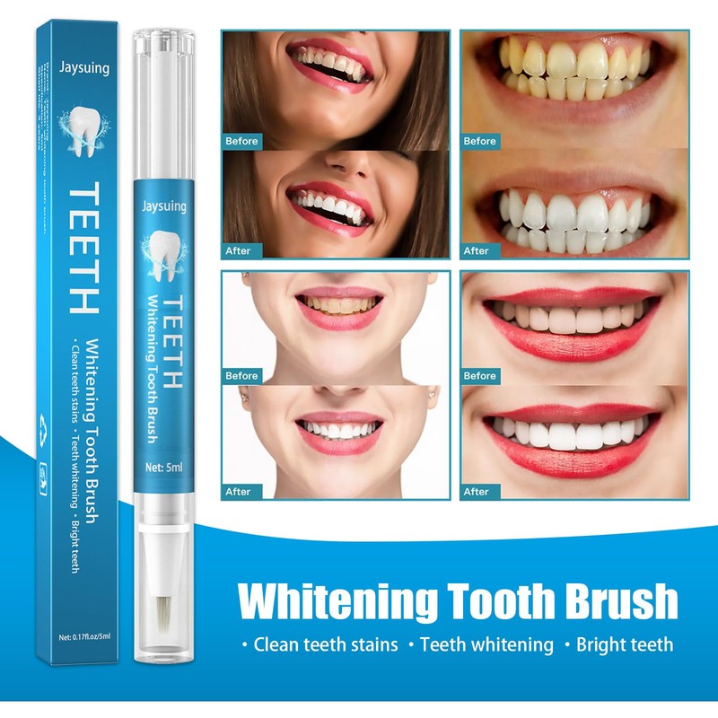 Teeth Whitening Pen - Fast, Easy and Travel-Friendly | Instant