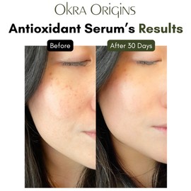 10x Antioxidant Serum for Face | Hyaluronic Acid, Niacinamide, Green Tea, Aloe Vera, and More | Hydrating Lightweight Nourishing Sap