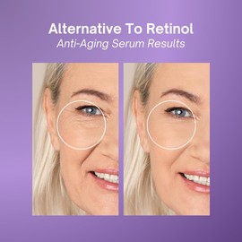 Excuse My Frank Bakuchiol Age Defense Serum, for Smoothing Fine Lines and Wrinkles, Anti Aging, Hydrating Cream