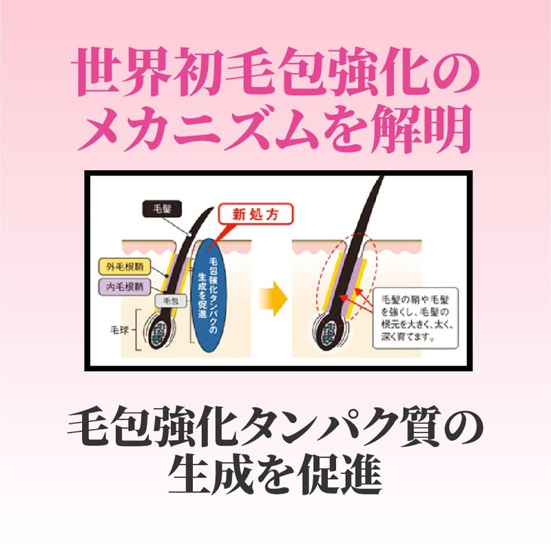 【医薬部外品】モウガL 女性用育毛剤 60mL 女性向け