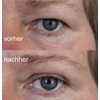 Schlepflid Tape® "pretty size" (M) eyelid lift without surgery [240