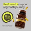 Advanced Trichology EFA Completo con Óptima Omega 3 6 9