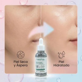 Pielrapida Serum Acido Hialuronico 1.5% Suero Facial Hidratante Profundo Rellenador Lineas De Expresion Antiedad 30ml