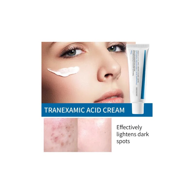 Crema Tx Para Manchas Oscuras E Hiperpigmentación Tx Tranexa