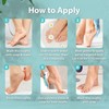 Ebanel Professional Callus Remover for Feet with 20% Urea, Epsom