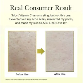 2Pzs Crema Suero Vitamina C (5%) Y Glutatión Para Rostro Y Ojos. Booster Iluminador Y Reafirmante Facial Antienvejecimiento, Aclara Manchas E Hidrata 