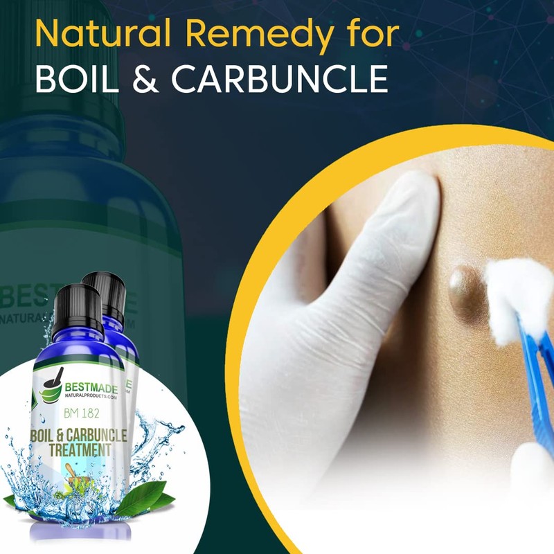 Boil & Carbuncle B, Maximum Strength Natural Drops That Help
