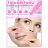 Kit De Agujas Para El Acné, 50 Agujas Desechables Y