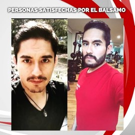 Bálsamo de Bergamota 20% para Crecimiento de Barba y Bigote | Tratamiento Estimulador para Rellenar Huecos y Zonas sin Pelo | Activa y Engrosa el Vello Facial | Auxiliar para Barba más Gruesa y Uniforme | Cuida la Piel | Orgánico